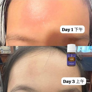 你會怎麼用Valor勇氣精油? *